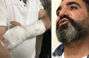 Avukata arabuluculuk ofisinde bıçaklı saldırı