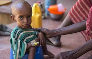 Somali’de gıda sıkıntısı nedeniyle 500 bin çocuk ölüm riskiyle karşı karşıya