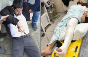 Buldan: Milletvekilimiz Habip Eksik polisler tarafından darp edildi ve ayağı kırıldı
