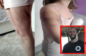Kız arkadaşını beyzbol sopasıyla dövdükten sonra tahliye edilip şantaj yapan erkeğin cezası 10 ay hapis!