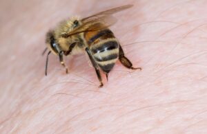 Bilim adamları açıkladı : Arı sokması neden ölümcül olabiliyor