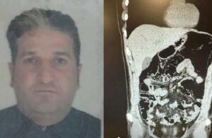 Türkiye’ye gelen İranlı iş insanının midesinden 300 gram eroin çıktı