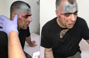 Gazeteci Sinan Aygül’e saldıran korumalar tutuklandı