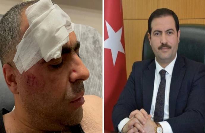 Korumaları gazeteciye saldıran AKP’li belediye başkanı günler sonra özür diledi