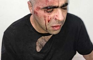 Gazeteci Sinan Aygül: Tatvan belediye başkanının korumalarının saldırısına uğradım