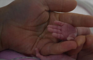 Araştırma: Dünya geneli canlı doğan her 10 bebekten biri prematüre doğuyor