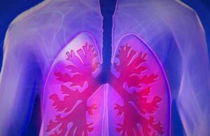 Akciğer kanserinin 10 önemli belirtisi! İnatçı öksürüğe dikkat