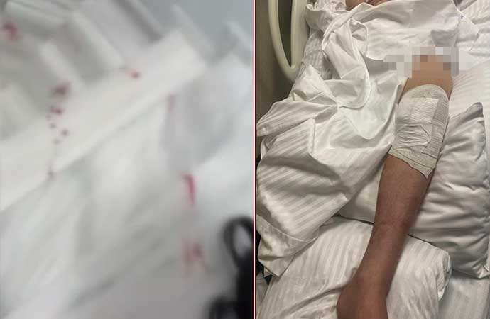 13 yaşındaki çocuk kar maskesi takıp arkadaşını bıçakladı!