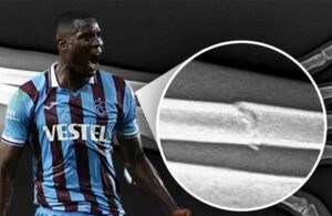Onuachu’nun kolu kırıldı, Trabzonspor tepki gösterdi: VAR’da göremediğinizin röntgen görüntüsü