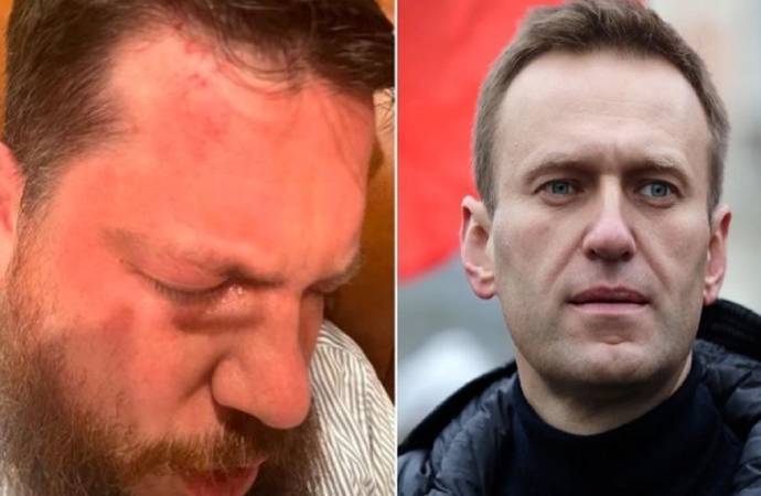 Cezaevinde ölen Navalni’nin yardımcısına çekiçli saldırı