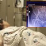 Özel hastanede skandal ihmal! Doğum yapan kadının karnında unutulan gazlı bez 10 ay sonra fark edildi