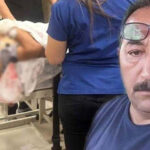 MHP’li eski başkanın kardeşi CHP’li üyeyi silahla ağır yaralamıştı!  Sebep ‘Topal’ şarkısıymış