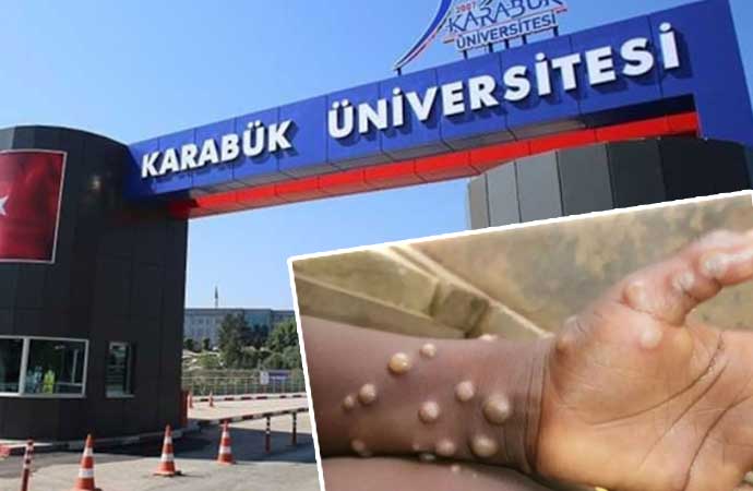 5 binden fazla Afrikalı öğrencisi olan Karabük Üniversitesi’nden ‘M çiçeği’ açıklaması